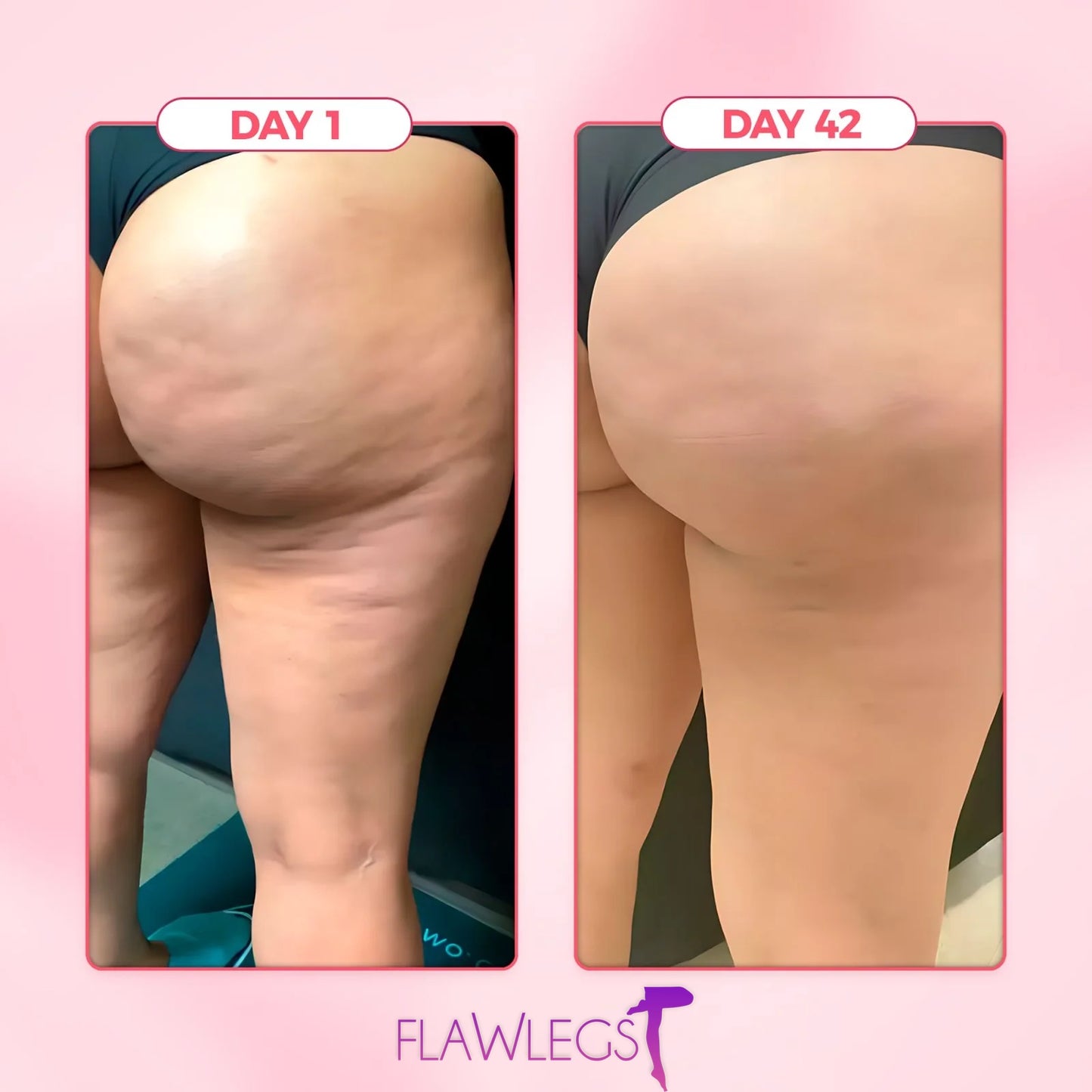 FlawLegs - The celebs Anti-cellulite tights